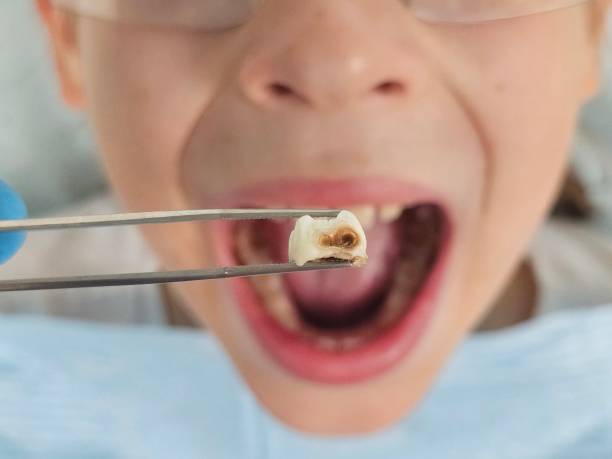 Best Emergency Pediatric Dentist  in Kearney, MO